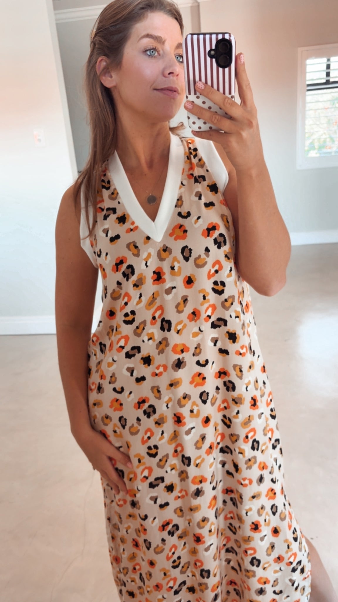 SUNNY LEOPARD DRESS